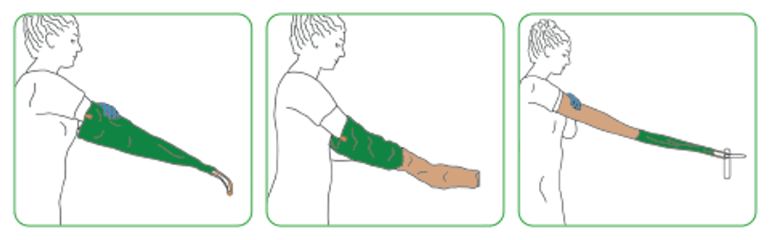Easy-Slide ARM